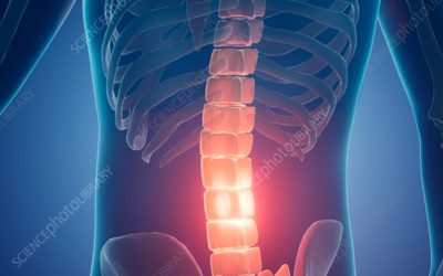 Spine & Musculoskeletal Ailments